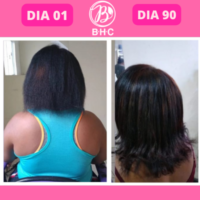 Antes