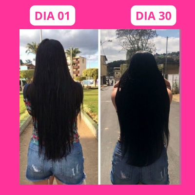 Antes
