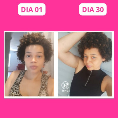 Depois